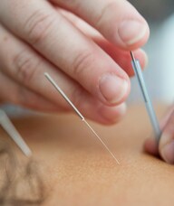 Book an Appointment with Dr. Kirsten Collins for Traditional Chinese Medicine Acupuncture